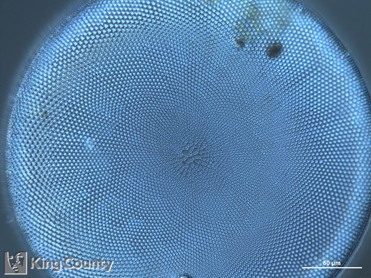 Photo of Coscinodiscus spp.